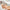 Oxygen-Infusion.jpg__PID:da337fd5-66db-4db4-a3e7-940733534a57